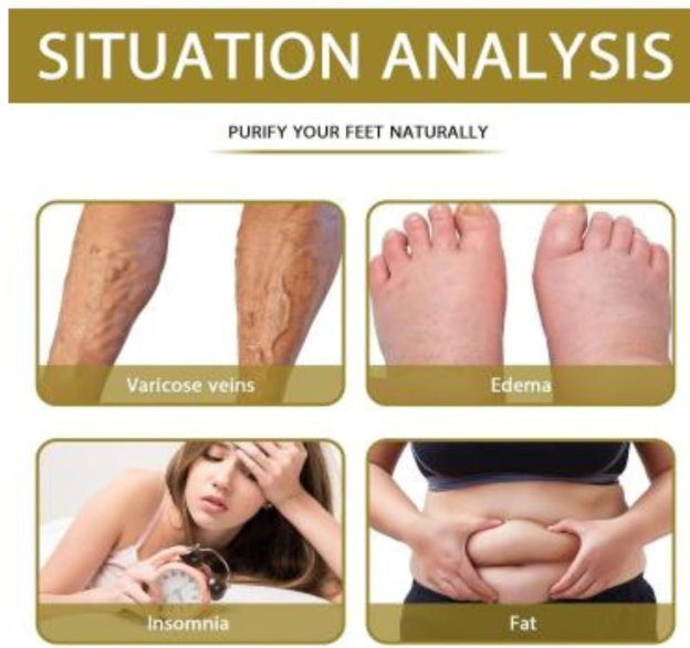 Bee Venom Foot Patches Stress Relief Detox Patch Solution, Belly Drainage Lymphatic Drainage, Cleansing Toxin Remover Foot Pads Deep Sleep Patch For Men & Women (Pack of 2=20 Patch)