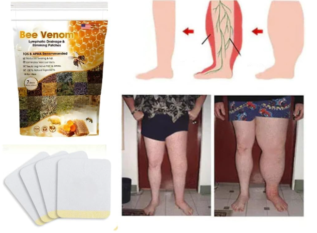 Bee Venom Foot Patches Stress Relief Detox Patch Solution, Belly Drainage Lymphatic Drainage, Cleansing Toxin Remover Foot Pads Deep Sleep Patch For Men & Women (Pack of 2=20 Patch)